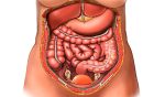 Pachet Paraziti intestinali - imagine 2